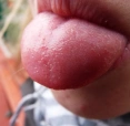 lidkaxx